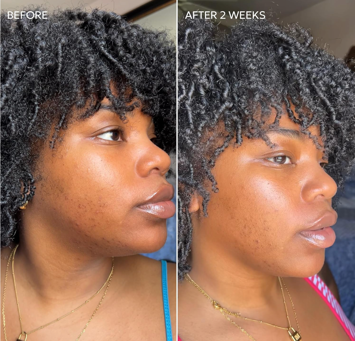 Dermisa Skin Fade Cream with Vitamin C
