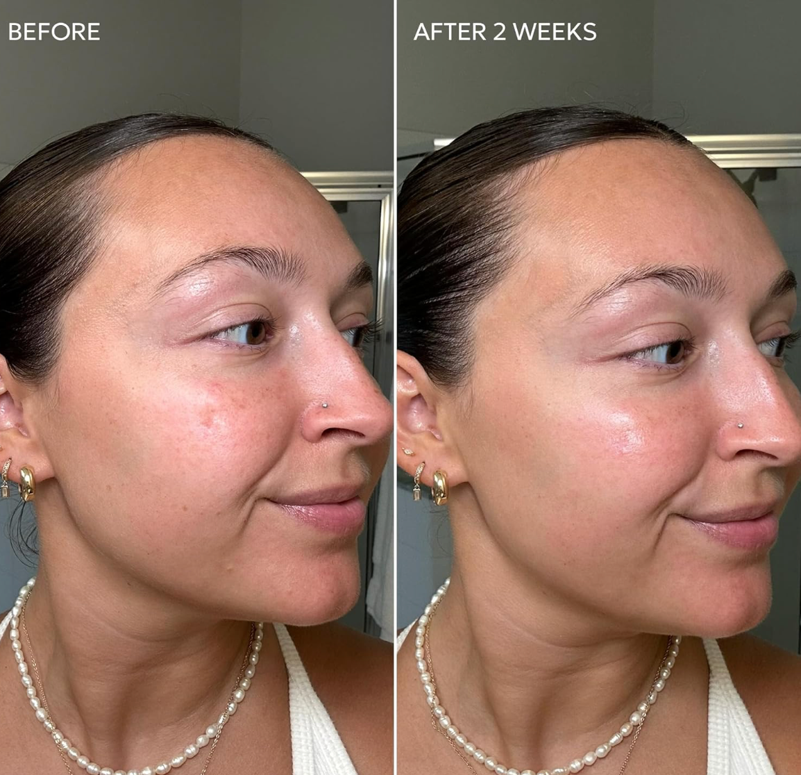 Dermisa Skin Fade Cream with Vitamin C