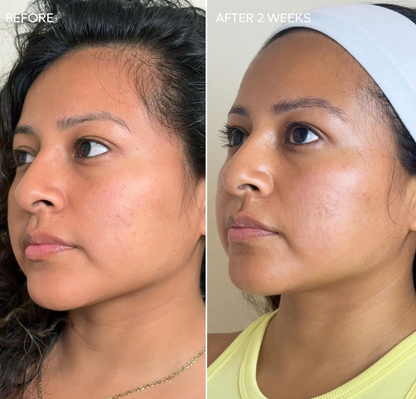 Dermisa Skin Fade Cream with Vitamin C
